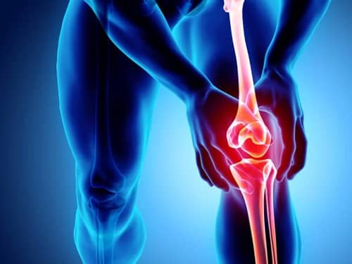 Chronic knee pain