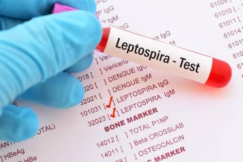 เล็ปโตสไปโรซิส (Leptospirosis)