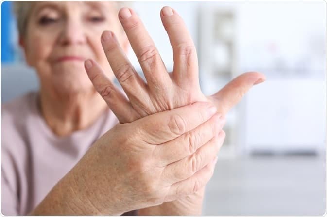 รูมาตอยด์ (Rheumatoid arthritis)