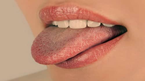 ลิ้นเป็นฝ้า (White Tongue) : อาการ สาเหตุ การรักษา