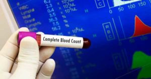 Complete Blood Count : CBC