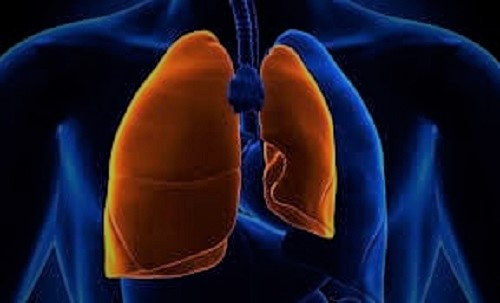 Pneumothorax-Collapsed Lung