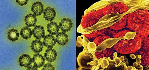 ติดเชื้อแบคทีเรียและไวรัส