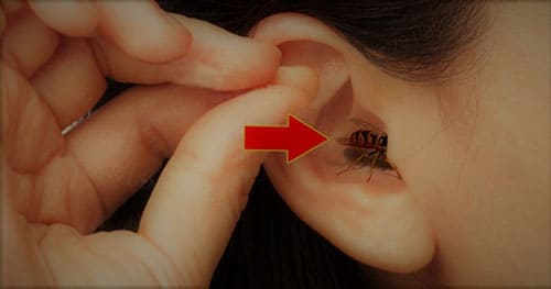 แมลงเข้าหูทำอย่างไร