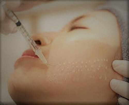 What is Mesotherapy 