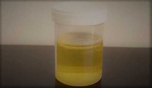 foamy urine
