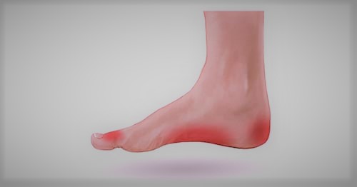 bottom of foot pain 