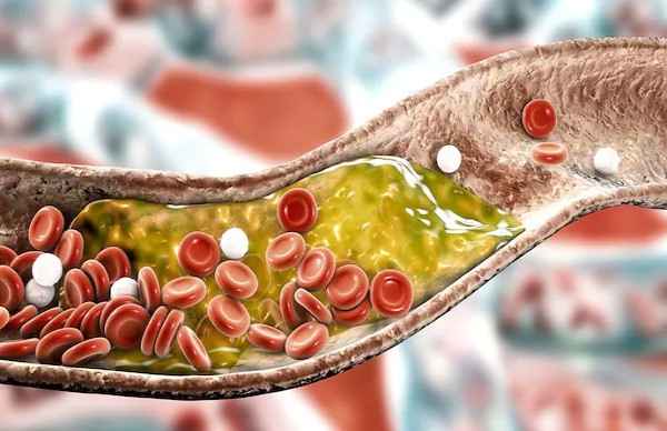 Facts About Cholesterol